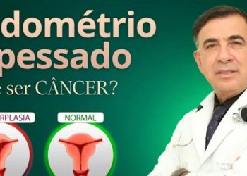 ENDOMÉTRIO ESPESSADO: PODE SER CÂNCER?
